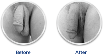 Ultra Power Capsule!