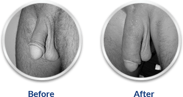 Ultra Power Capsule!